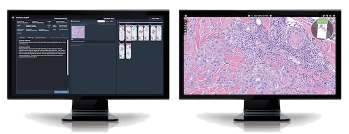 Dynamyx by Inspirata is being implemented at the One Dorset Pathology Network by local enterprise support partner Fujifilm UK.