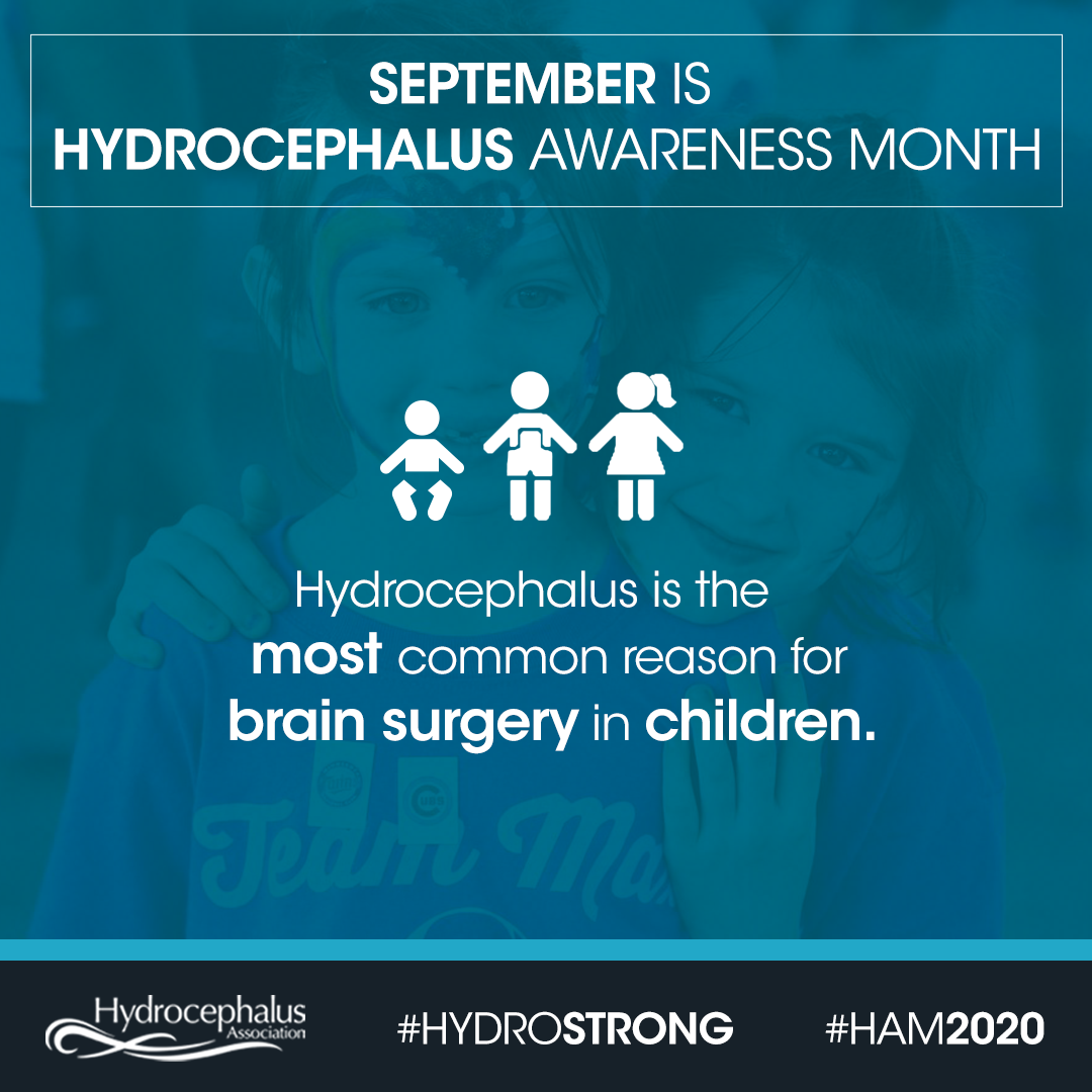 Brain surgery is the only treatment for the over 1 million people living with hydrocephalus in the United States. 