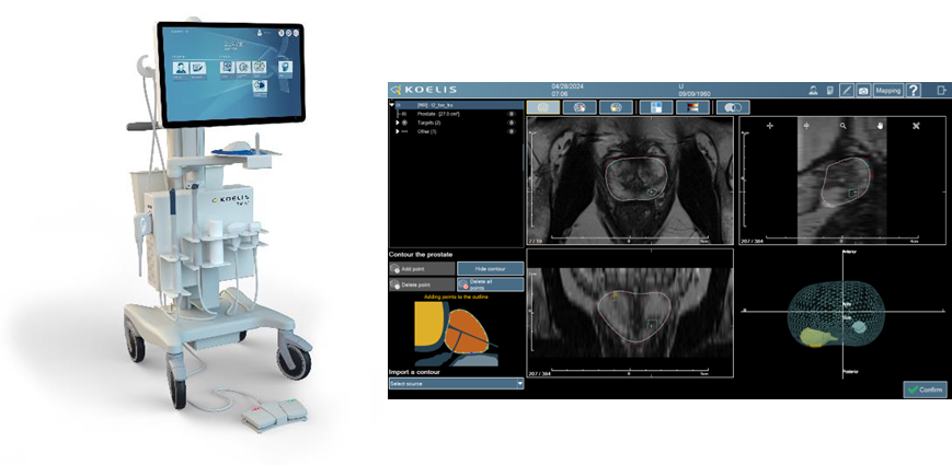 Trinity image with MRI segmentations screenshot.