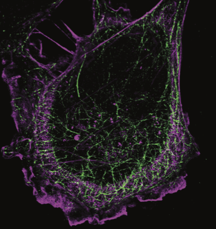 3Dsuperresolution