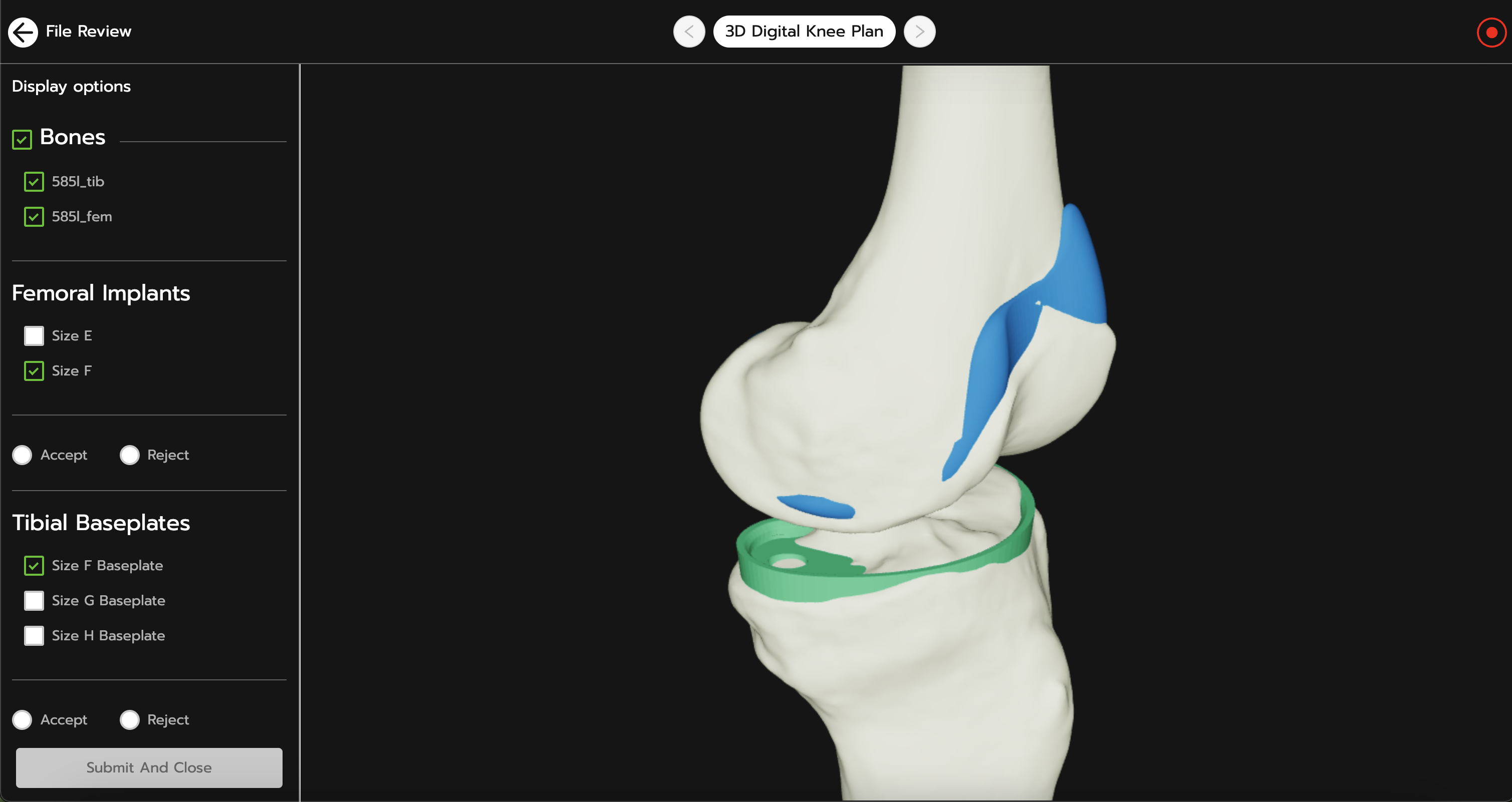 surgicalcaseportal_3dviewer