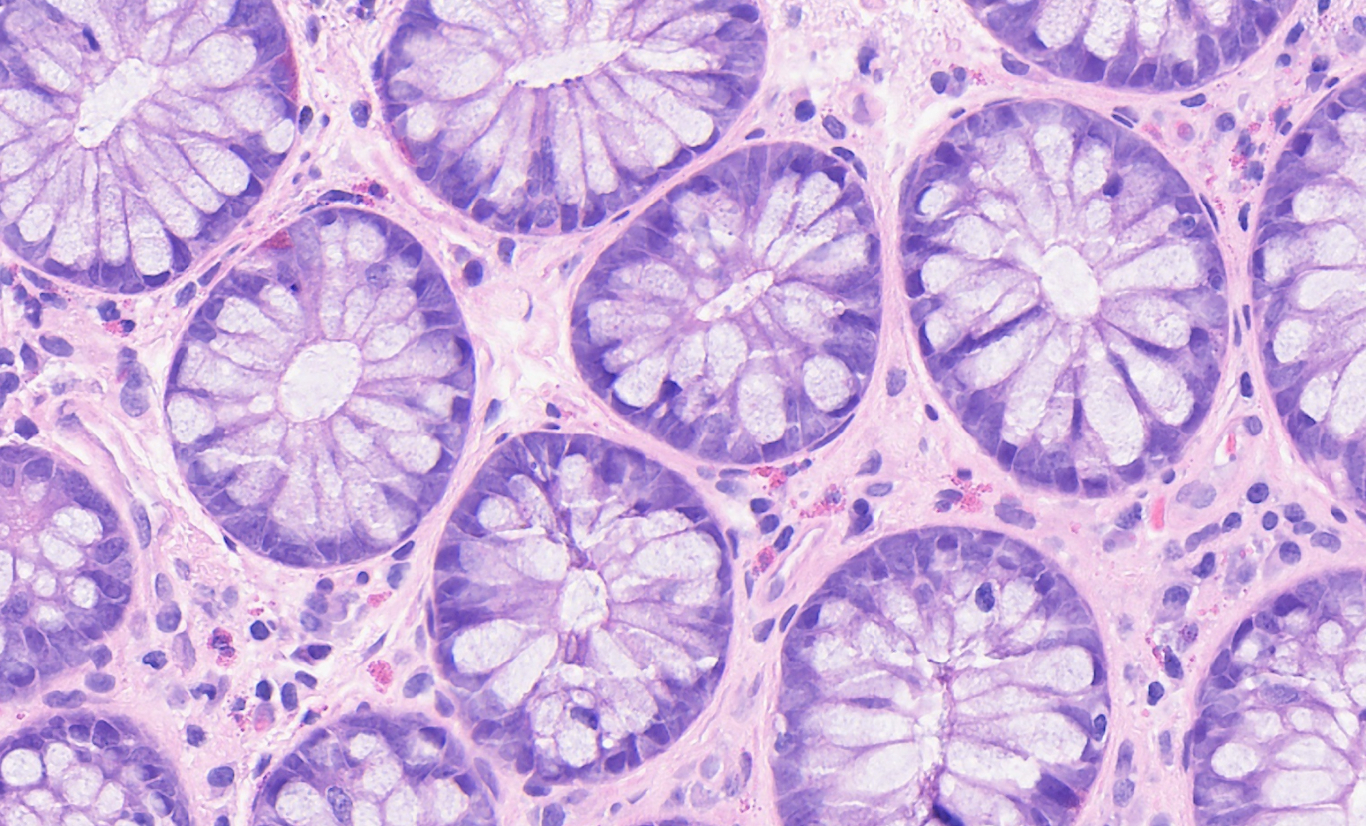image1.db9b3403 (2)