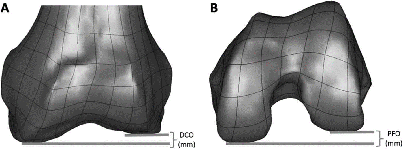 Femoral Offset Geometries