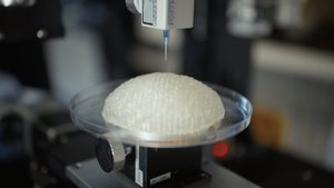 BioRegenerative Ergonomically Architected Smart Tissue (B.R.E.A.S.T™), developed by Conexeu Sciences, Inc. and printed with support from the RegenMed Development Organization (ReMDO) at the Wake Forest Institute for Regenerative Medicine (WFIRM). The work reflects ReMDO's ongoing support of Conexeu Sciences' efforts to translate regenerative medicine technologies into clinical practice.