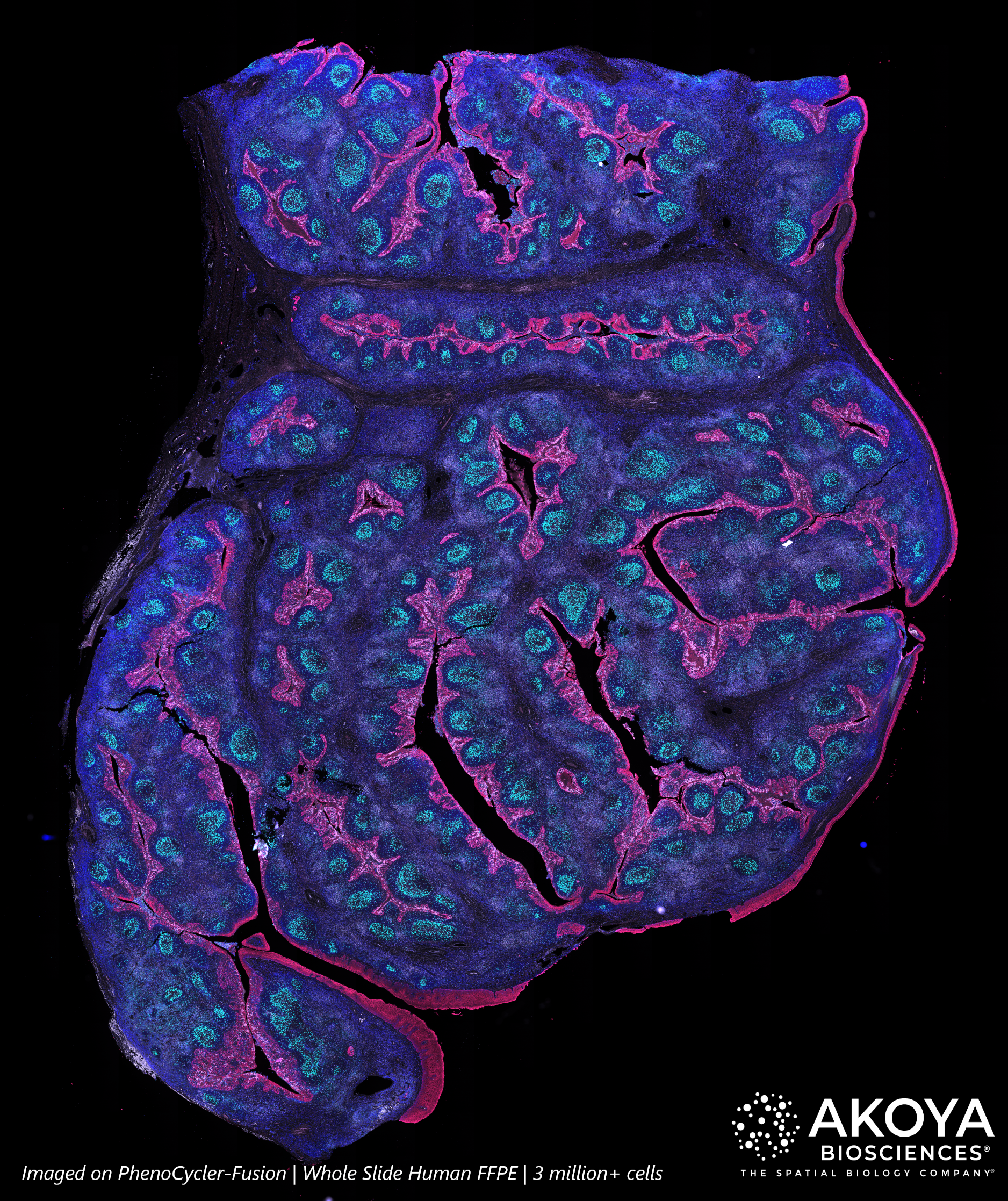 A whole slide human FFPE sample with more than 3 million cells, imaged on the PhenoCycler-Fusion.