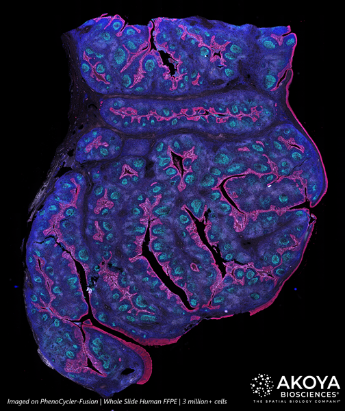 Spatial Day Imaged on PhenoCycler-Fusion_Whole Slide FFPE_3M+ Cells