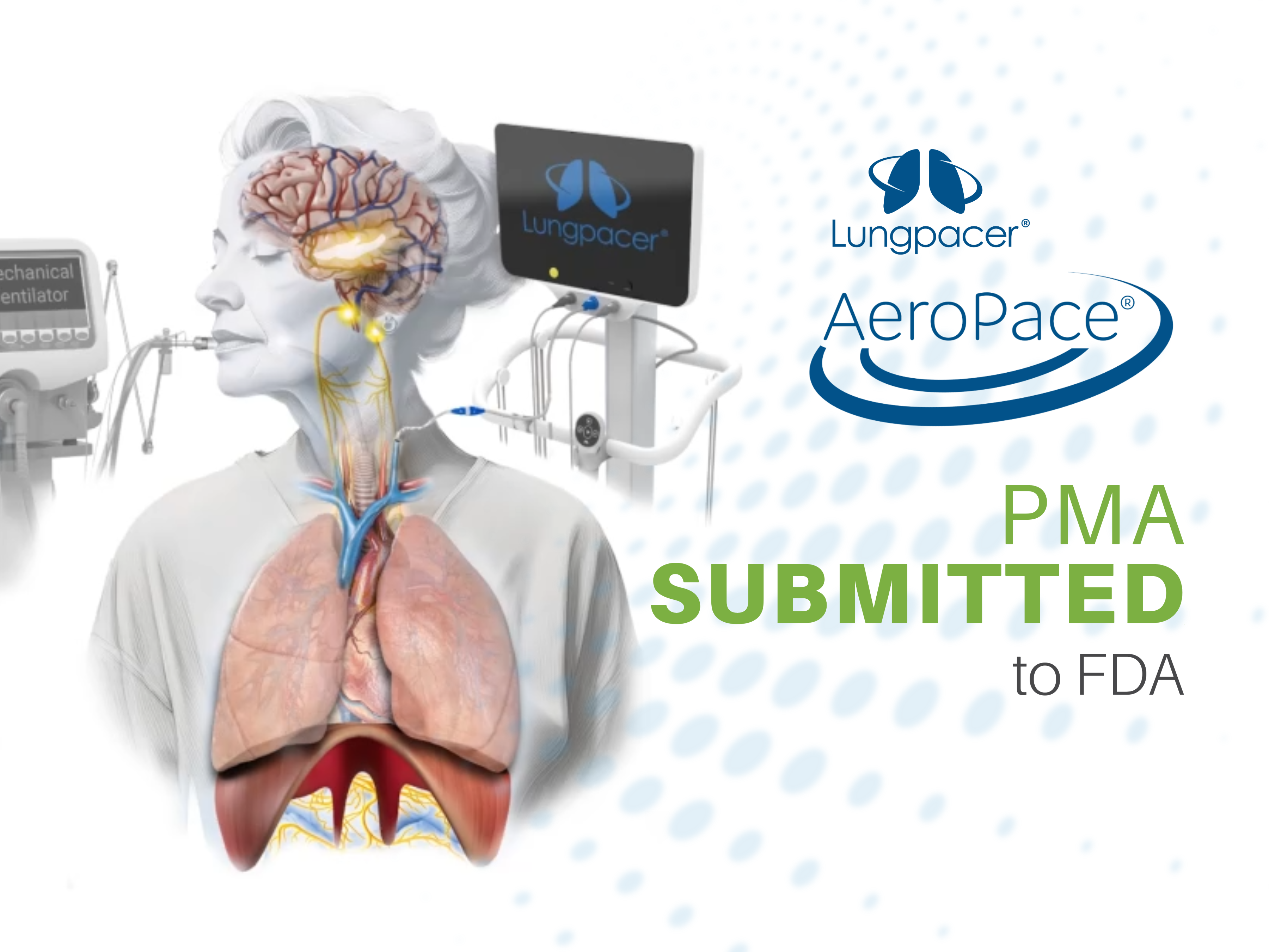 Lungpacer AeroPace PMA Submission Press Release