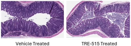 Representative H&E sections of intestinal tissue from an IBD mouse model without drug treatment showing a high degree of inflammatory cell activity (left) and with TRE-515 treatment with significantly less inflammation (right).