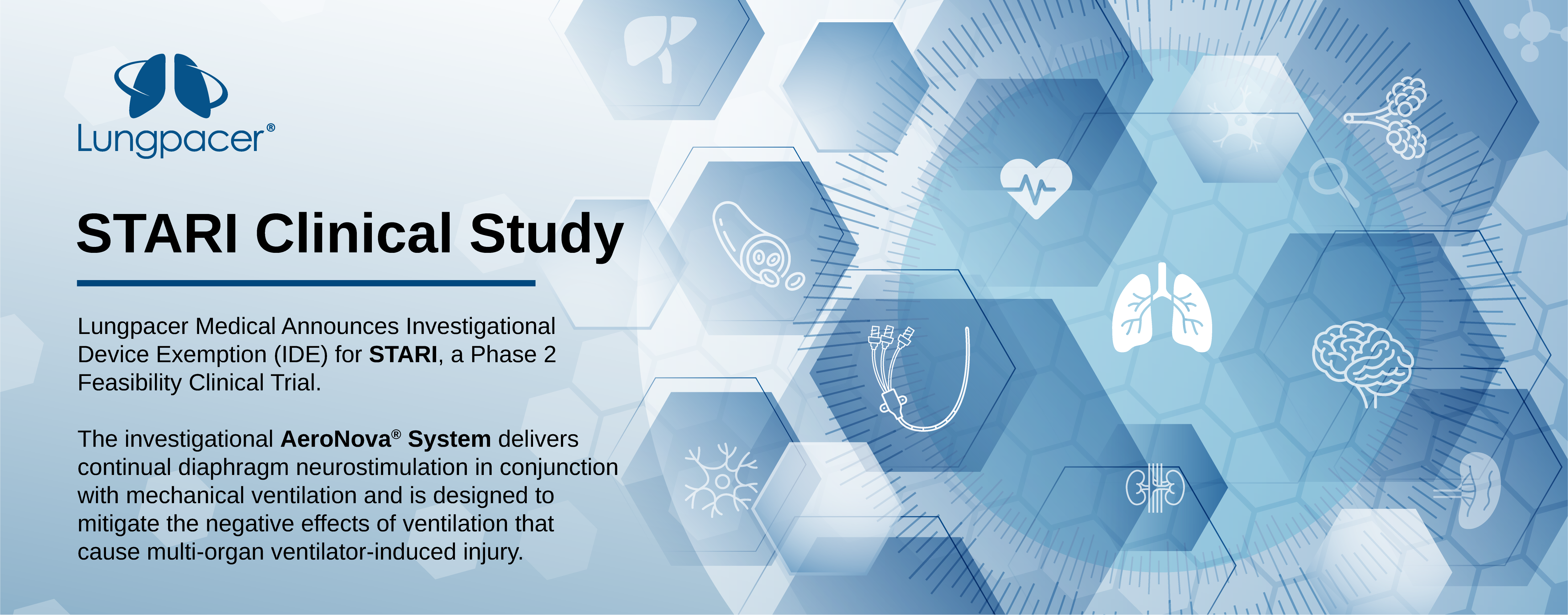 Lungpacer Announces IDE for STARI Clinical Study