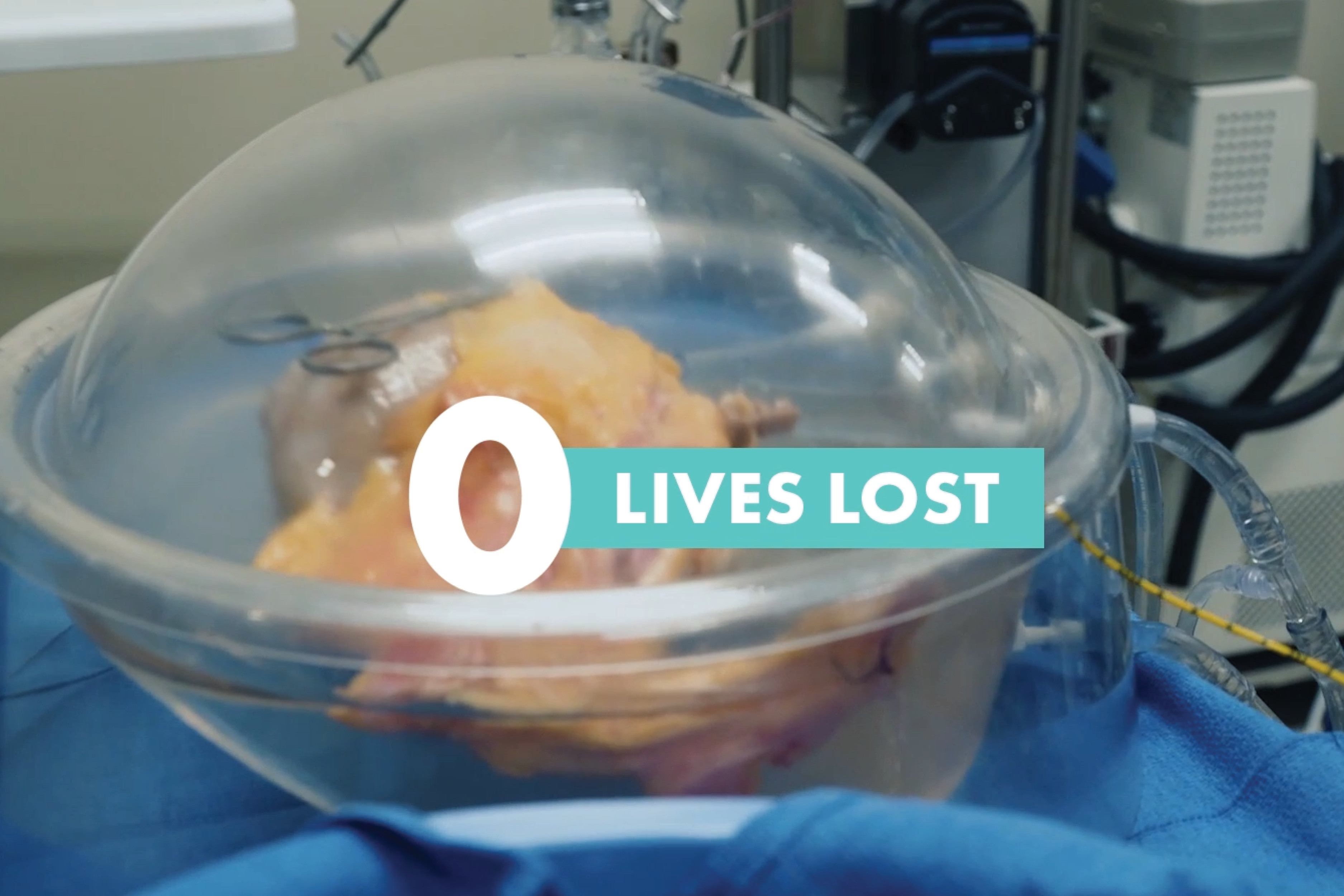 34 Lives has already saved 10 lives with “unusable” kidneys — and they’re just getting started 