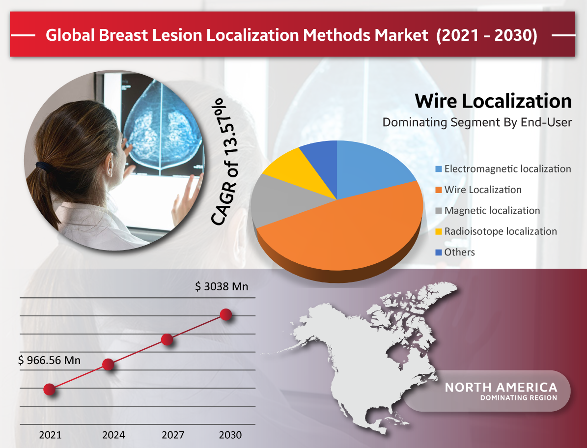 Overview: Breast – Localization & Treatment Procedures in Radiation Therapy