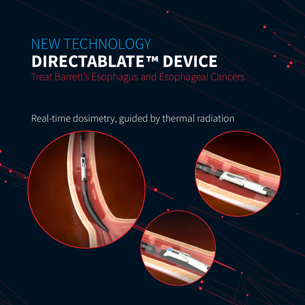 Directablate™️ Device