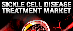 Sickle Cell Disease Treatment Market Globenewswire