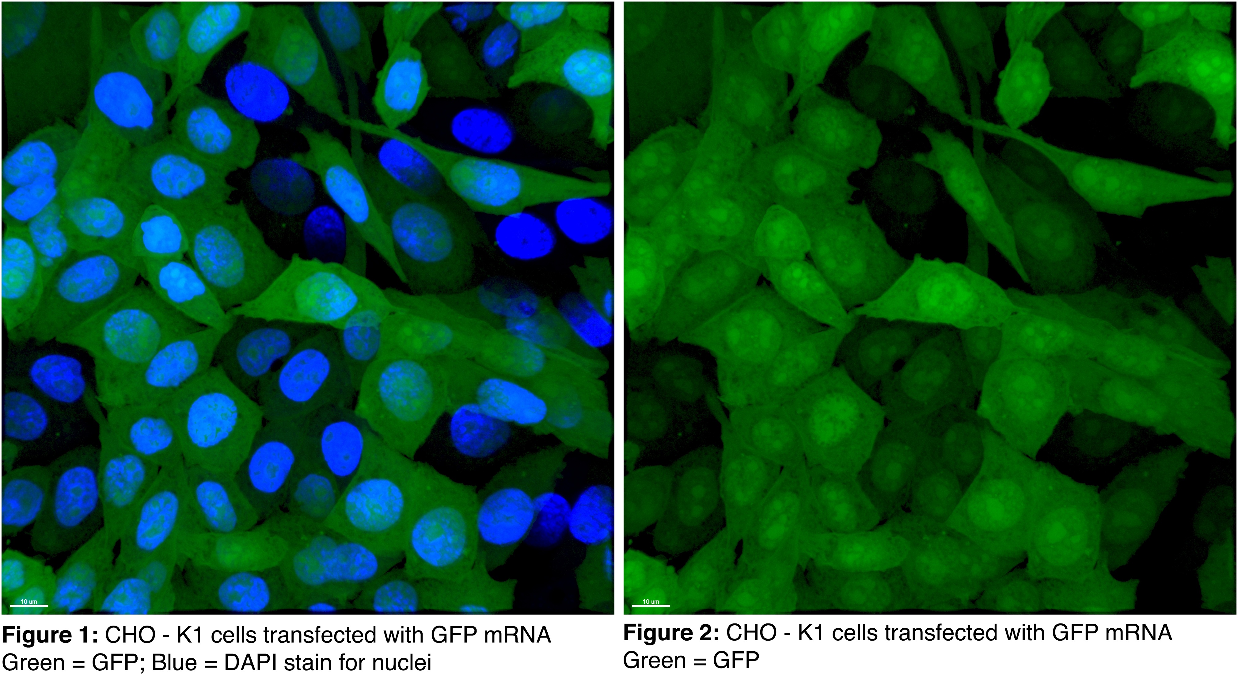 The DasherGFP mRNA encodes an IP-free, fluorescent protein engineered by ATUM, a collaborating partner with Aldevron, for optimal expression in mammalian cells. The expressed protein yields a bright green fluorescence allowing scientists to easily track and analyze mRNA delivery and translation.