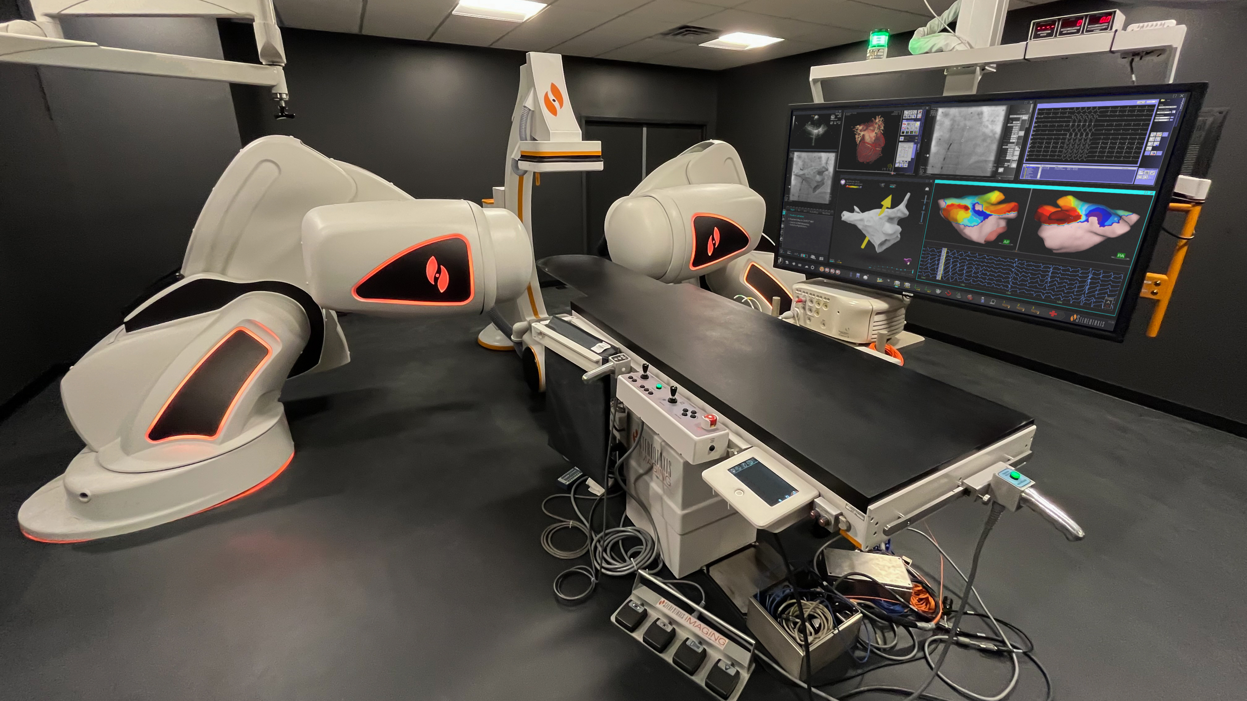 Stereotaxis Robotic Magnetic Navigation System