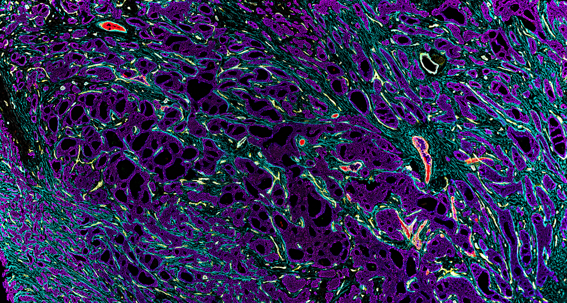 Nikon Breast Cancer CODEX Tissue Image