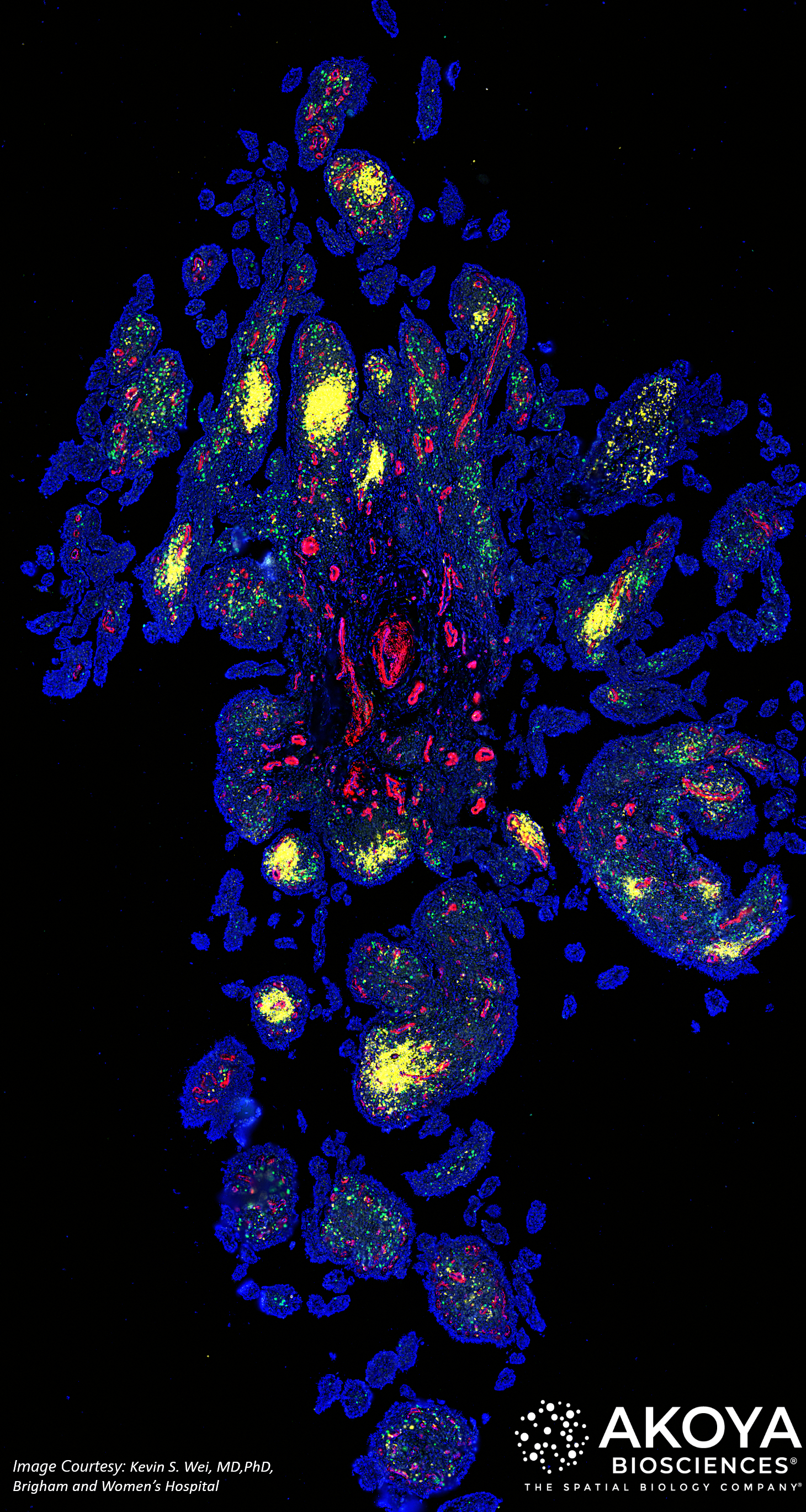 Arthritic knee-Human Synovial FFPE CODEX Tissue Image