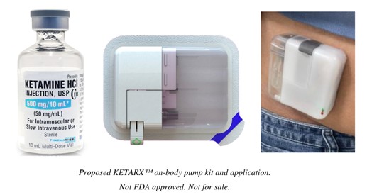 Proposed KETARX™ on-body kit and application. Not FDA approved. Not for sale.