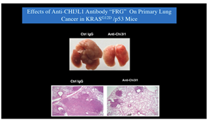 Effect of anti-CHI3L1 on Primary Lung Cancer
