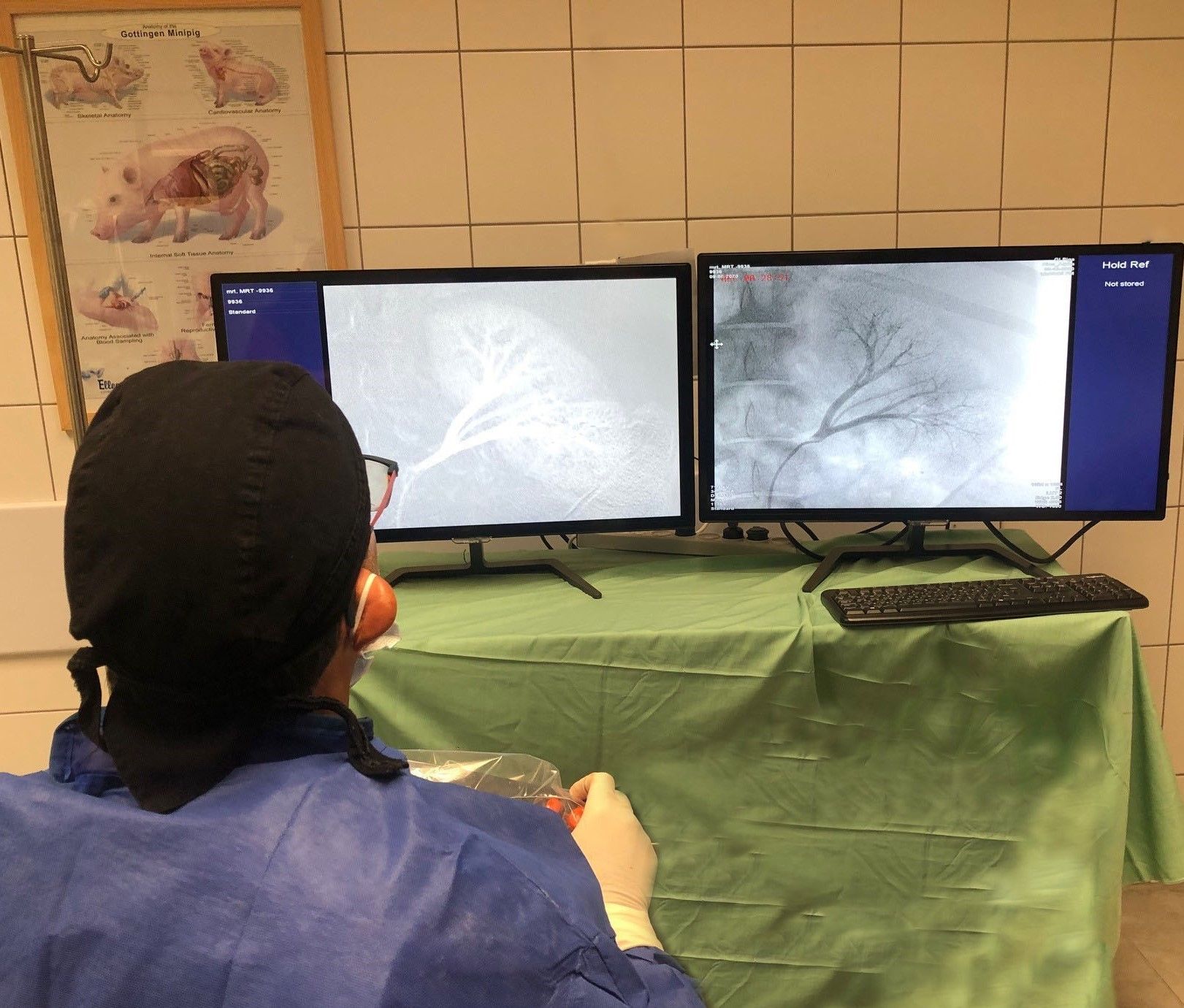 LIBERTY™ Robotic System being remotely operated