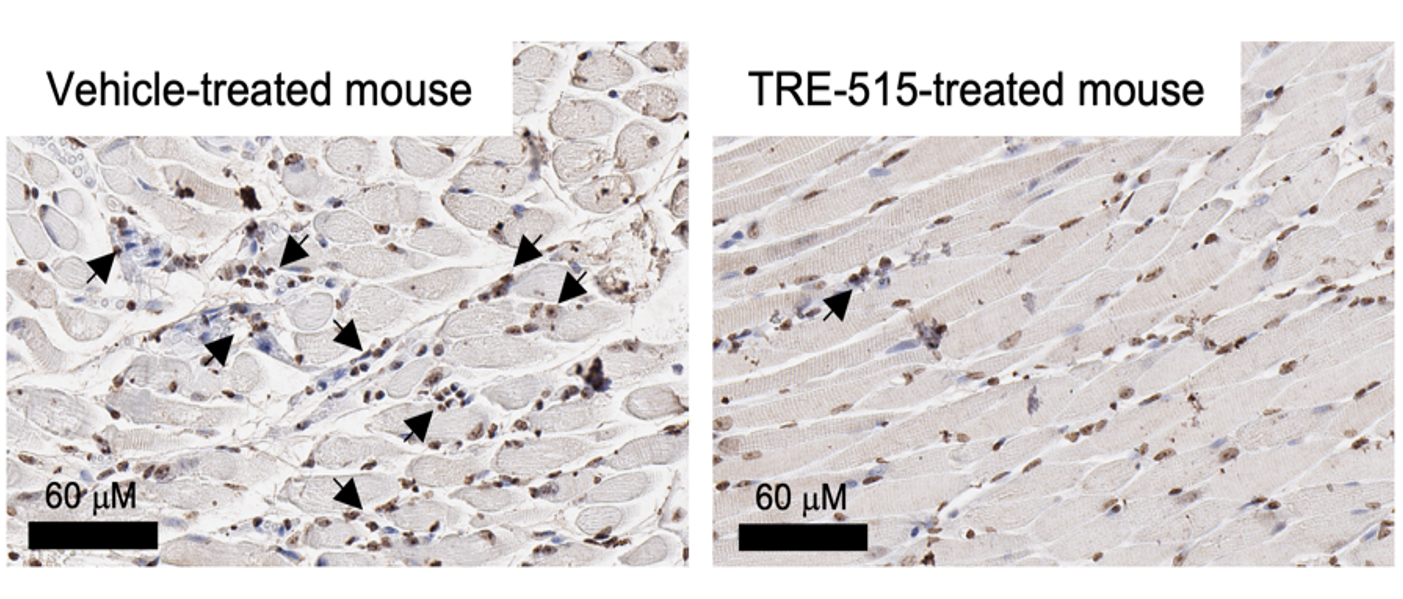 Representative stained sections of the optic nerve from a mouse ON model. Arrows point to regions of immune cell infiltration.