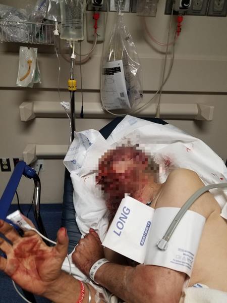 Mr. Singh was attacked in his own home during a suspected targeted attack on Aug. 12, 2019. 