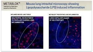 Mouse lung intravital microscopy showing Lipopolysaccharide (LPS) induced inflammation
