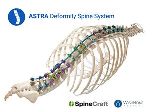 The comprehensive product system addresses a broad range of complex spinal pathologies with a low-profile design that allows surgeons to maximize bone graft.