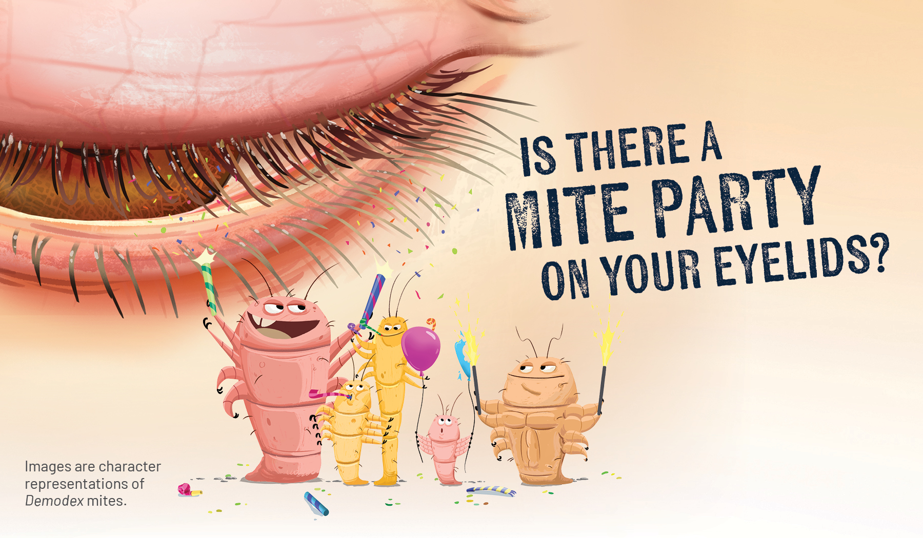 XDEMVY Mite Party