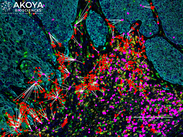 Image 4 -Akoya Lung Cancer FFPE tissue-Zoomed In Proximity Plot