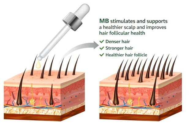 Mblue Labs Launches Next-Generation Hair Regeneration Technology4