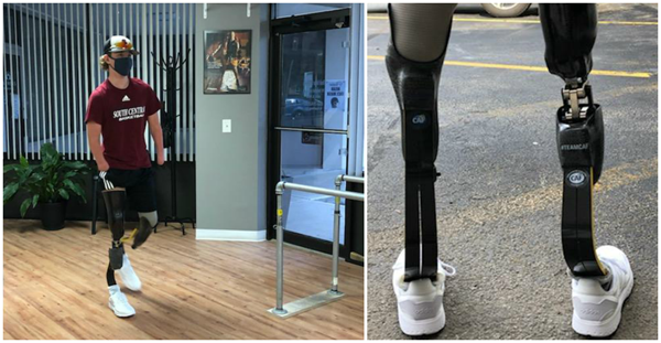 Quadruple amputee, Landis Sims (14 yrs old) was surprised by MLB legends with new Össur prosthetic running legs on behalf of Challenged Athletes Foundation and David Rotter Prosthetics.