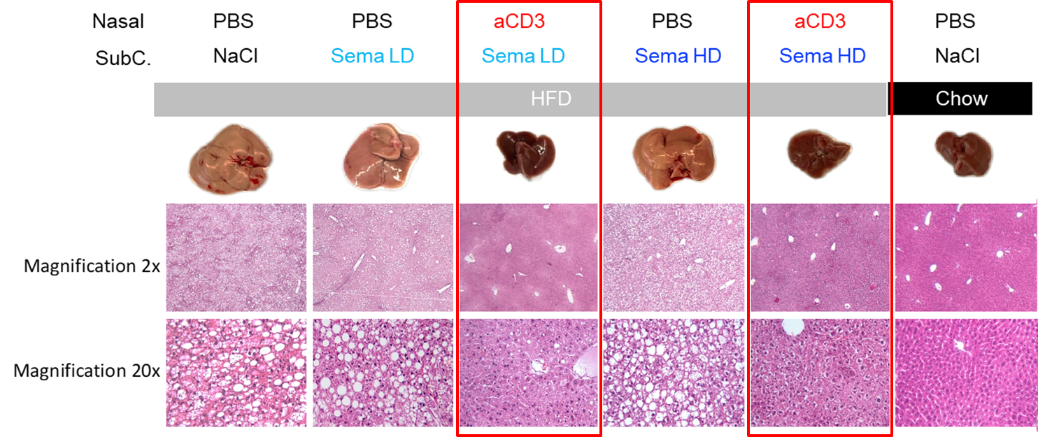 Figure 1: Nasal anti-CD3 with Low and High Dose semaglutide promote Liver Homeostasis in DIO