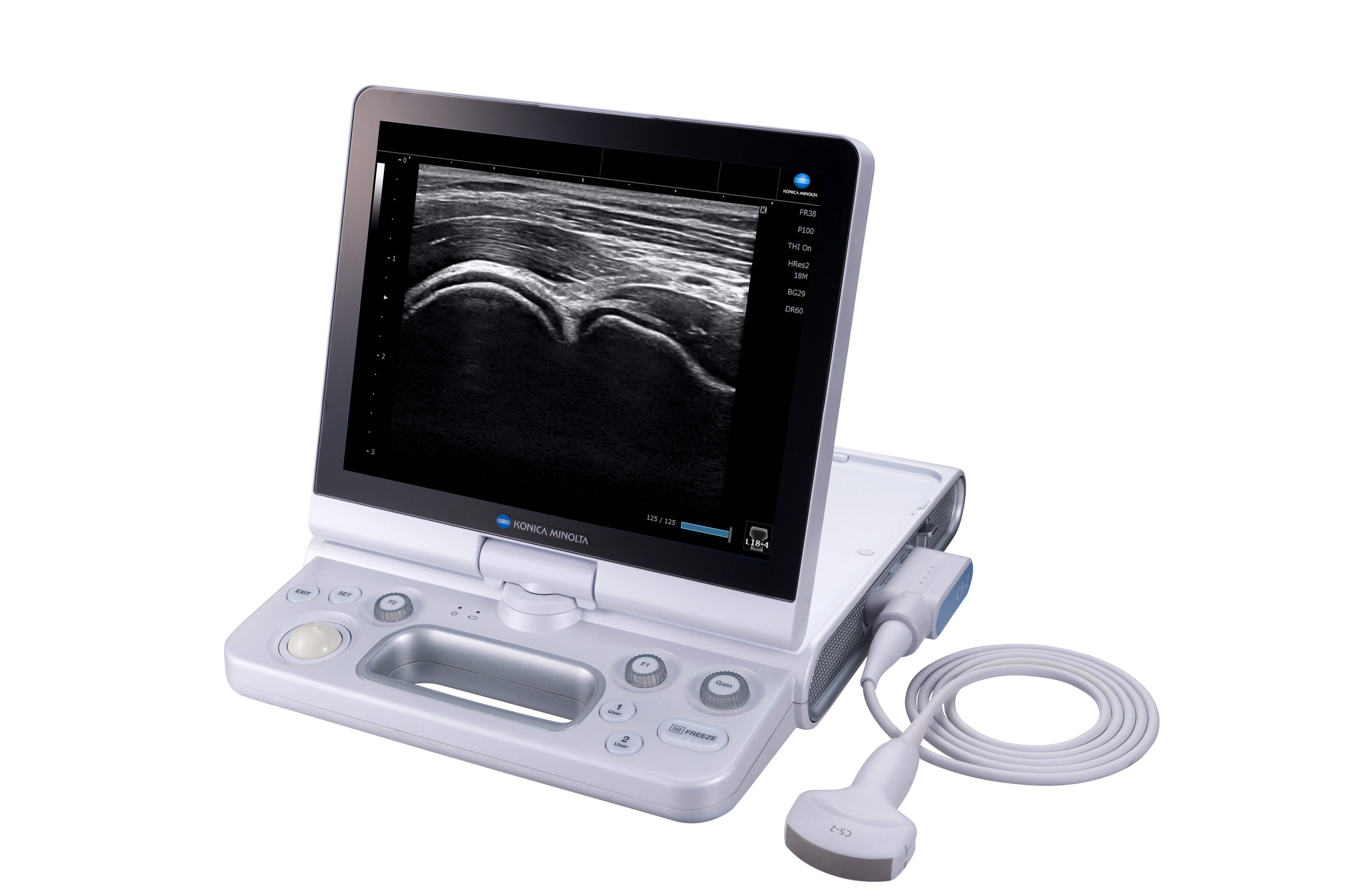 The new SONIMAGE® HS2 Compact Ultrasound System from Konica Minolta Healthcare.