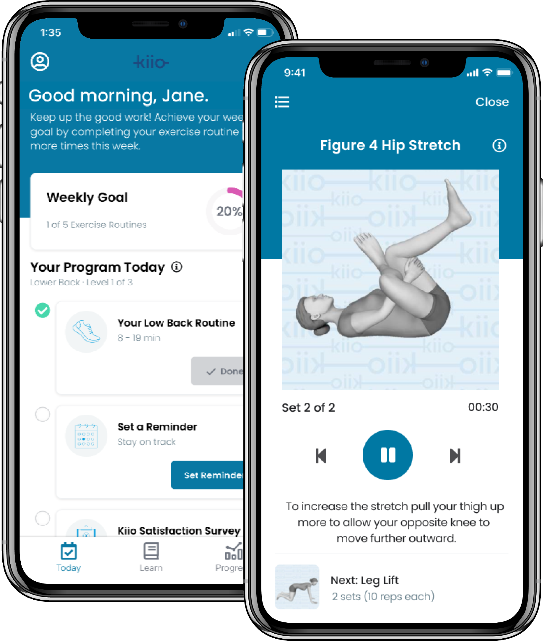 Kiio's simple, easy, and effective digital MSK therapy integrates clinical practice guidelines and advanced software to deliver on-demand, personalized therapeutic exercise and interactive virtual coaching using only a member’s smartphone or tablet – no waiting equipment, scheduling a consult, or learning how to use sensors or motion tracking. 