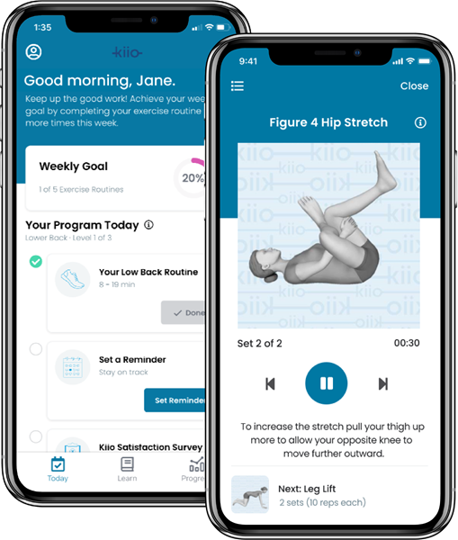 Kiio's simple, easy, and effective digital MSK therapy integrates clinical practice guidelines and advanced software to deliver on-demand, personalized therapeutic exercise and interactive virtual coaching using only a member’s smartphone or tablet – no waiting equipment, scheduling a consult, or learning how to use sensors or motion tracking. 