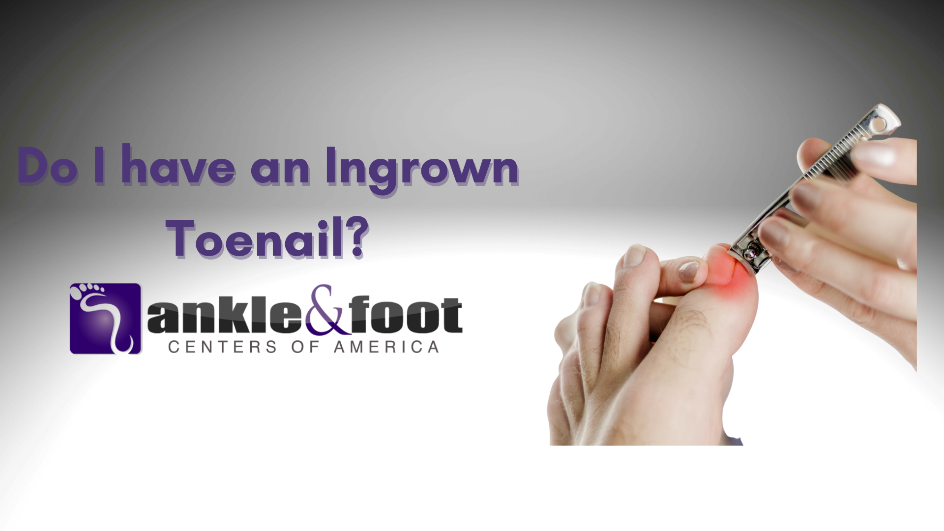 Ingrown Toenail