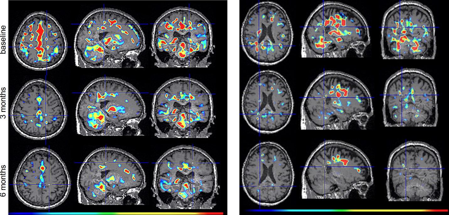 Tiziana Life Sciences, Ltd.