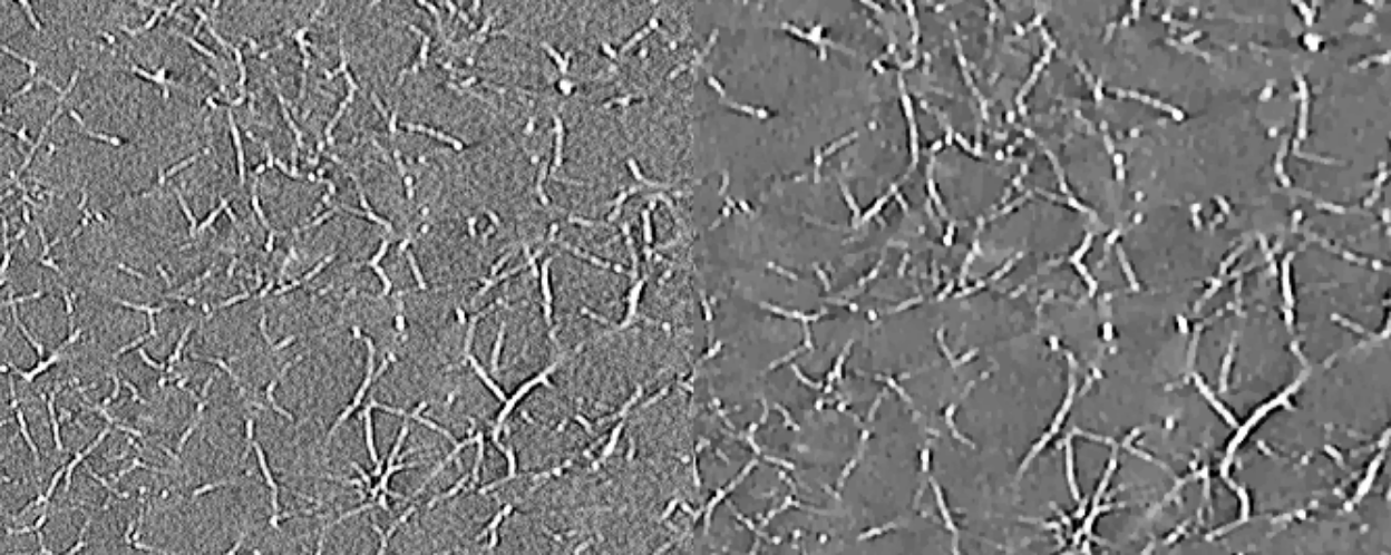 Image denoising with the new ITKTotalVariation remote module. Left: Transmission electron microscopy image of pectin. Right: Denoised image.
