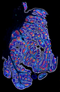 Whole-slide human FFPE sample with 2.5 million cells, imaged on the PhenoCycler-Fusion System. Map every cell for unbiased spatial phenotyping.