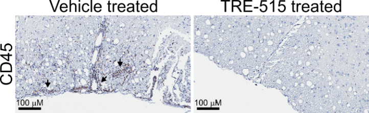 Representative stained spinal cord sections from a mouse ADEM model. Arrows point to regions of leukocyte infiltration.