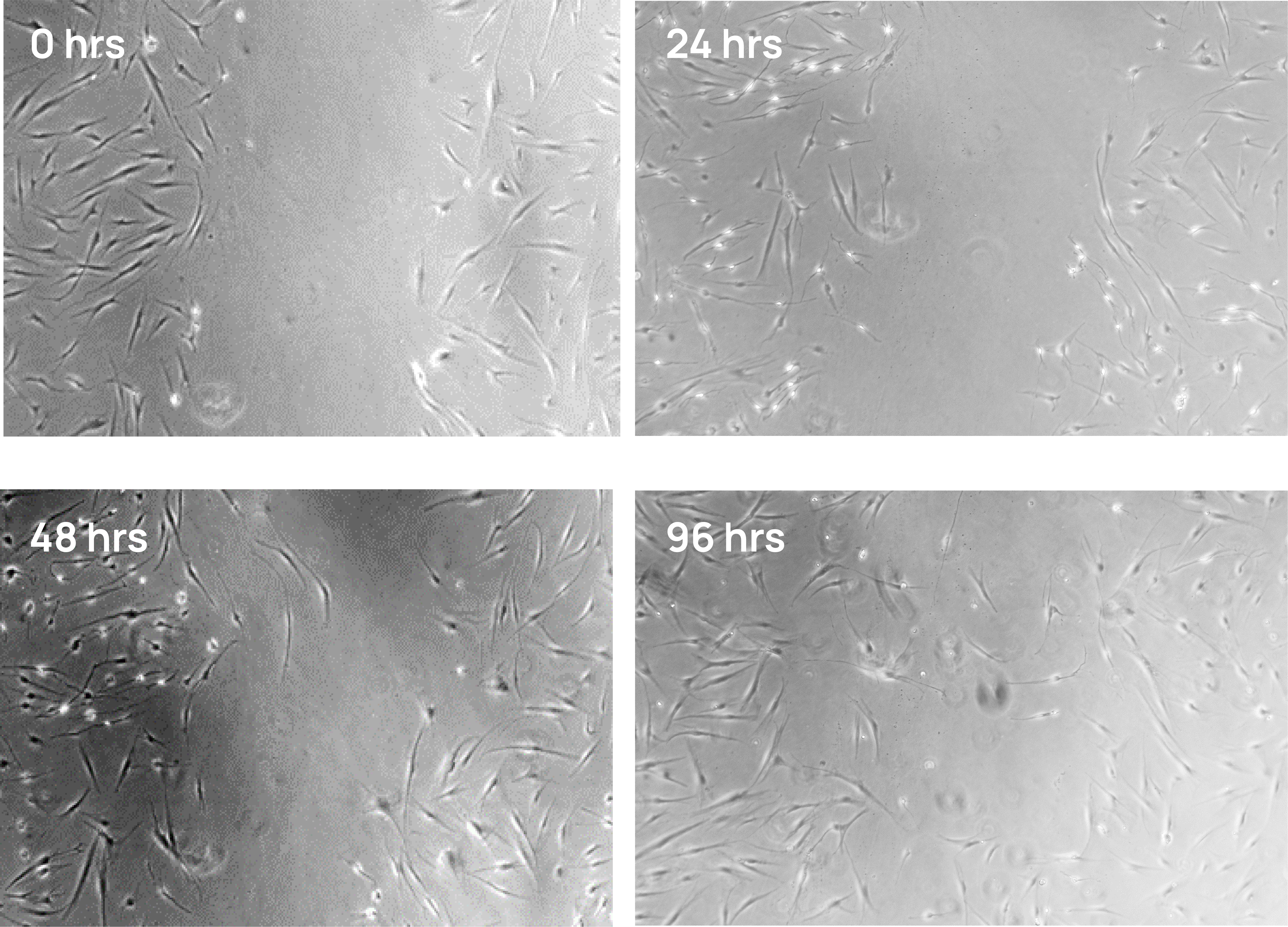 hiEX™ Research iPSC Exosomes promoted wound healing in an in vitro wound healing assay. For the detailed data, visit https://appliedstemcell.com/product/hiex-research-ipsc-exosomes/.