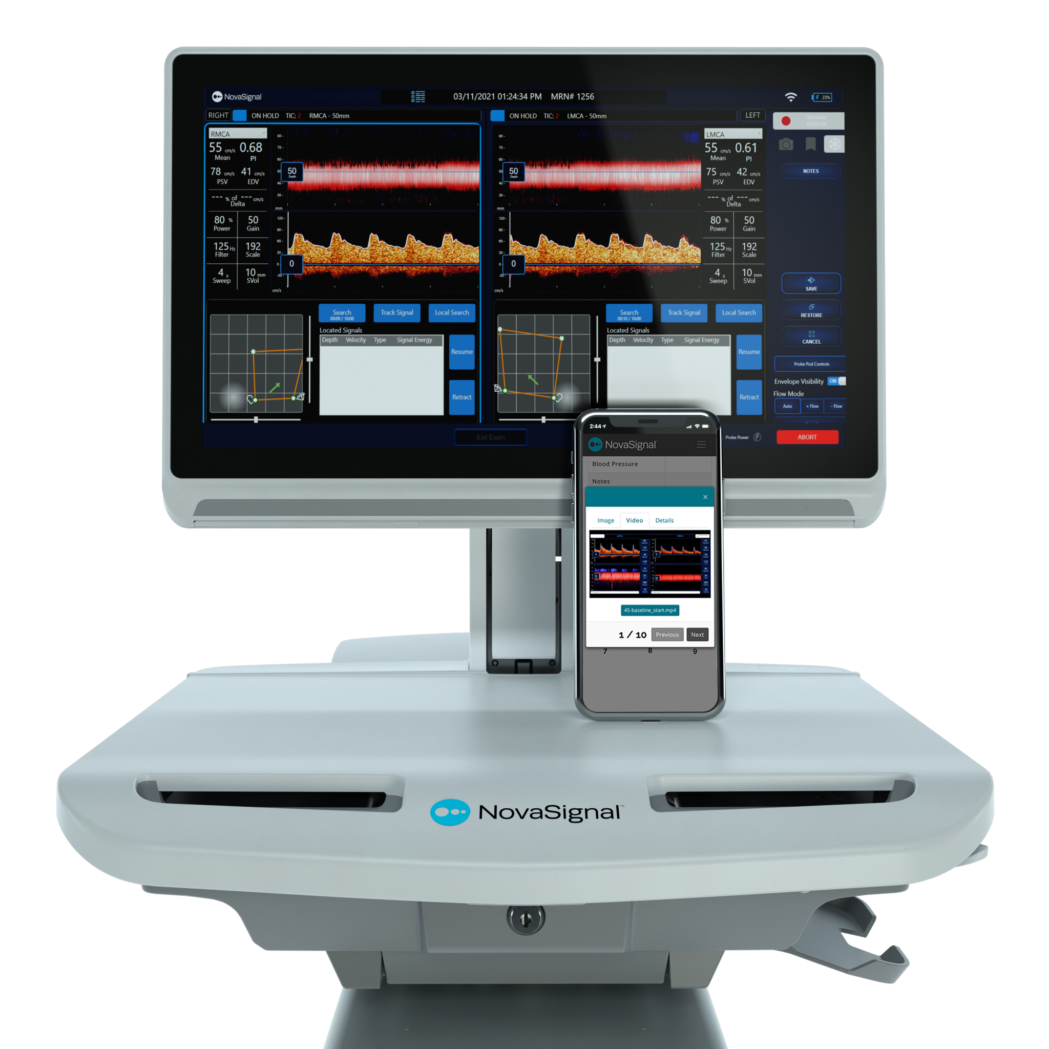 NovaGuide 2 Platform
