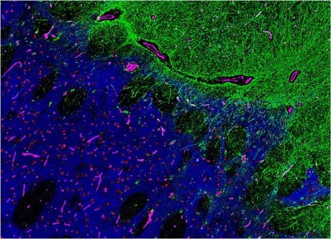 CODEX Brain Tissue Image