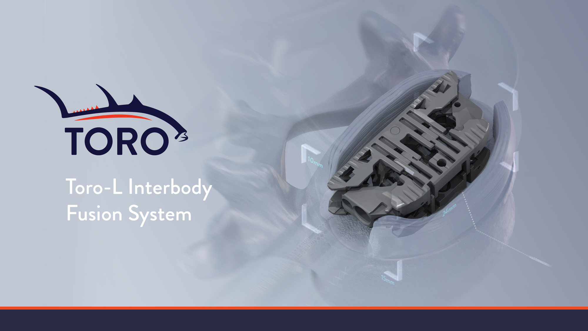 Accelus Receives U.S. FDA 510(k) Clearance for its Toro-L