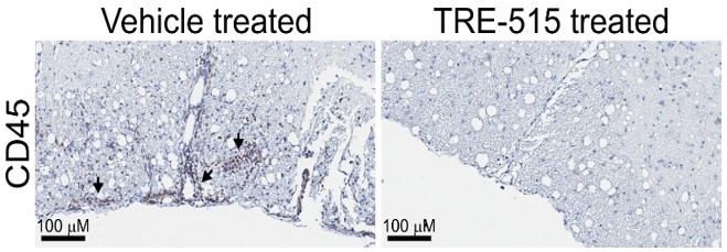 Representative stained spinal cord sections from mice. Arrows point to regions of leukocyte infiltration.