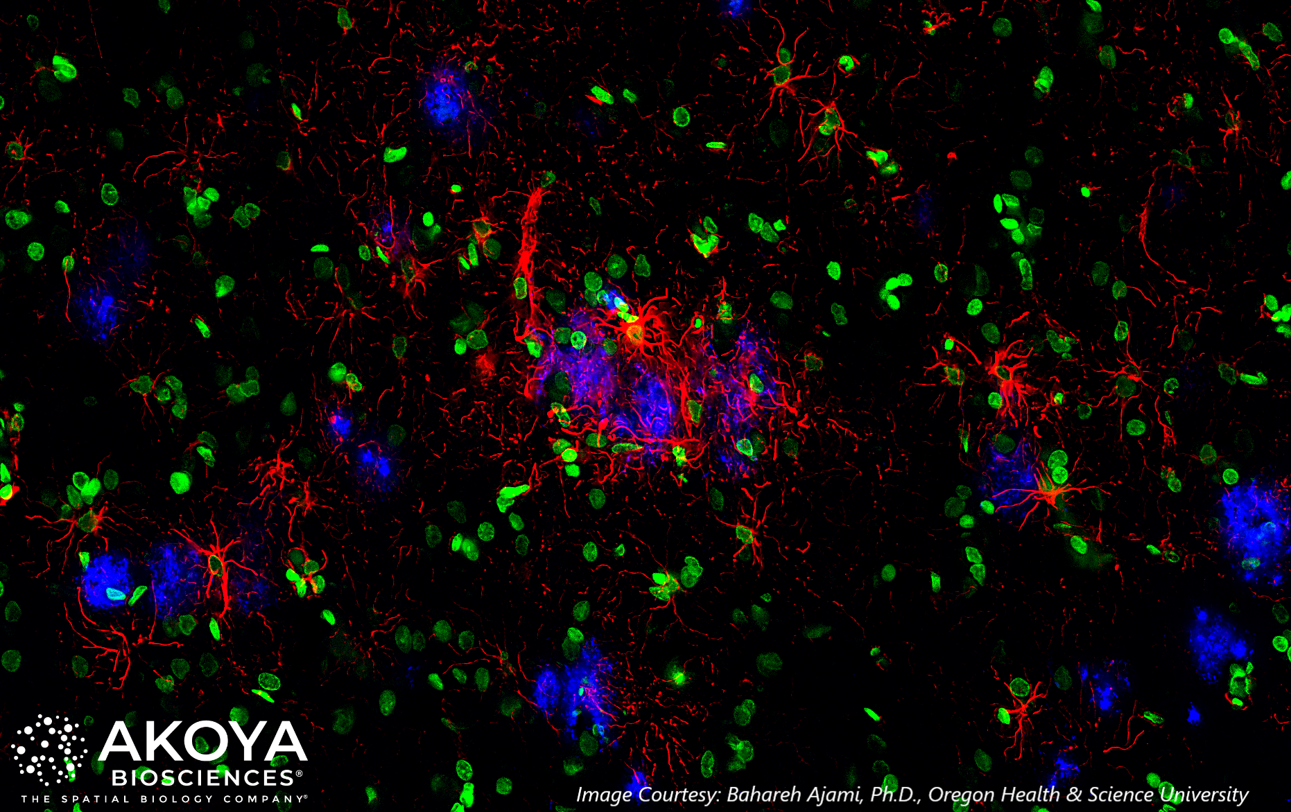 Zeiss release Akoya-Neuro Alzheimers Tissue Image 