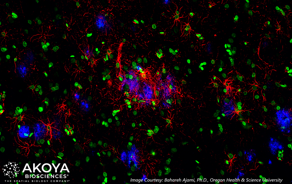 Zeiss release Akoya-Neuro Alzheimers Tissue Image 