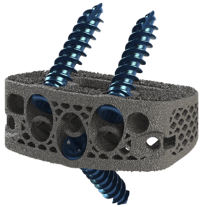 Manufactured from DeGen Medical’s Proprietary Titanium PURI-TI™ Diamond Lattice Structure Increases Visualization While Maintaining Mechanical Integrity.
