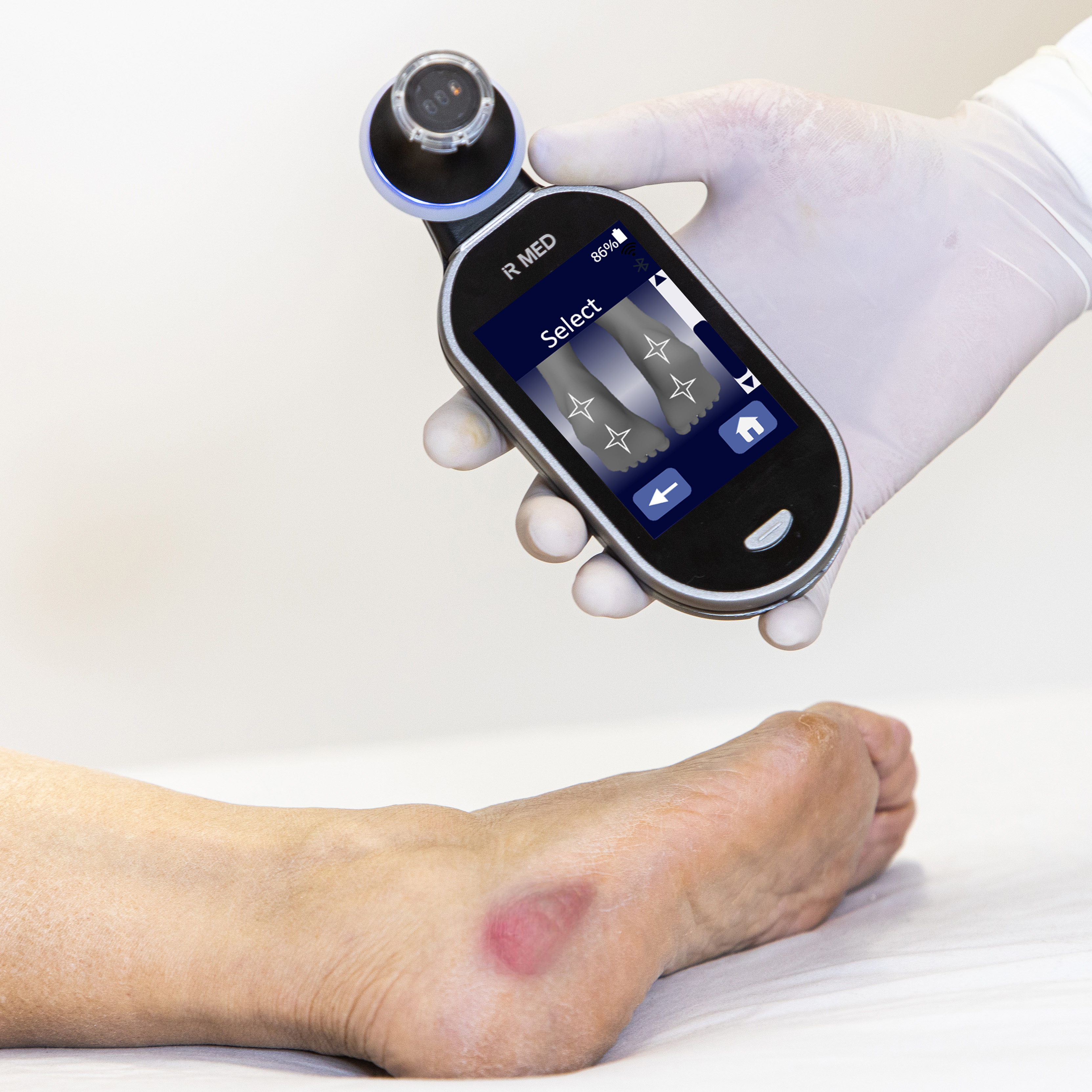 New Clinical Efficacy Data for Detection of Pressure Injuries with its AI- Based PressureSafe™ Device